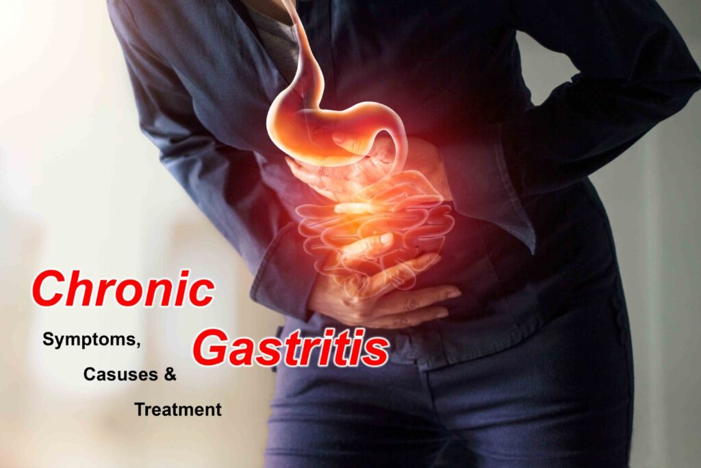 Chronic Gastritis