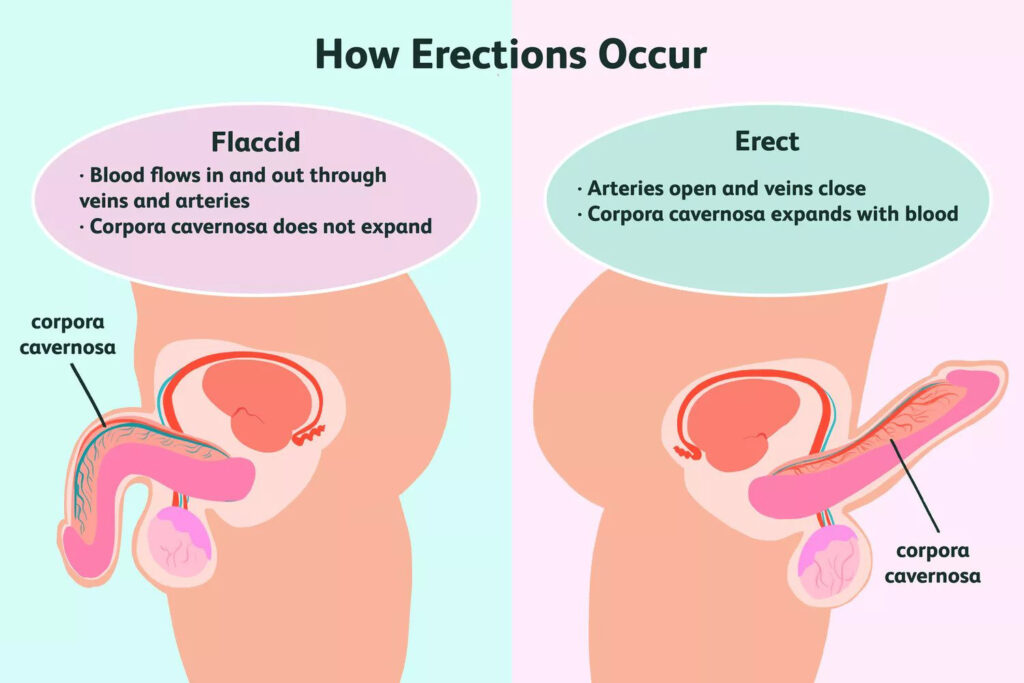 Erectile Dysfunction